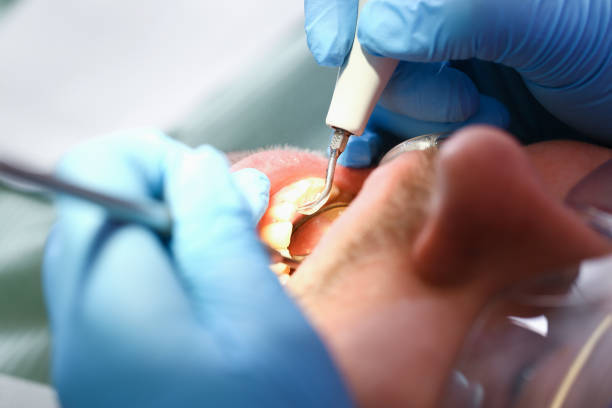Best Emergency Dentist for Lost Fillings or Crowns in Sleepy Hollow Lake, NY