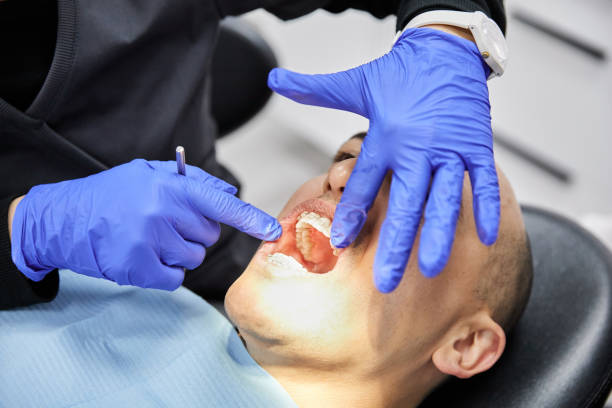 Best Emergency Dentist for Knocked-Out Tooth in Sleepy Hollow Lake, NY
